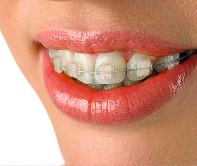 Ортодонтия 8