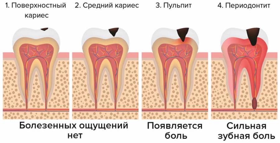 Лечение зубов 6
