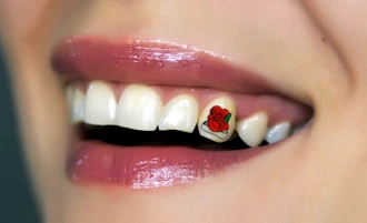 Украшение зубов - привлекательно и доступно 1